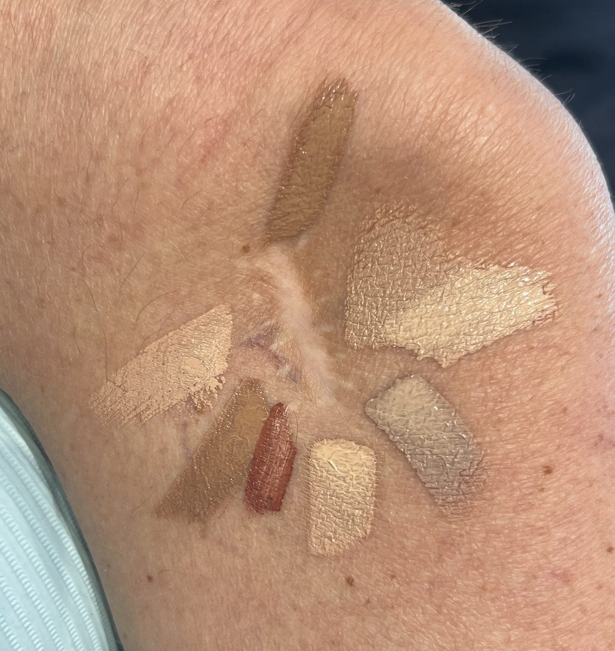Seven skin-tone pigment swatches painted around a pale scar on a client's arm, testing which mix matches the skin.